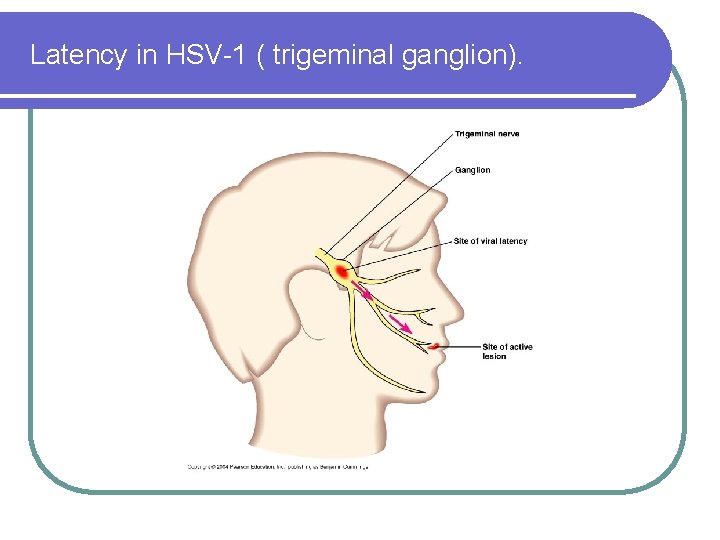 Latency in HSV-1 ( trigeminal ganglion). 