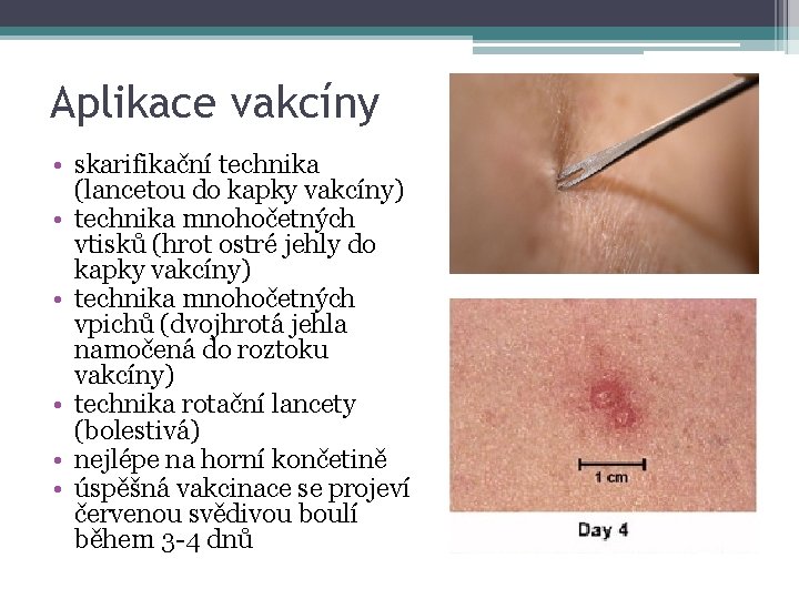 Aplikace vakcíny • skarifikační technika (lancetou do kapky vakcíny) • technika mnohočetných vtisků (hrot