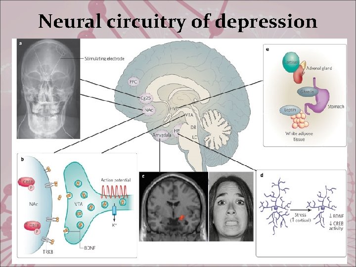 Neural circuitry of depression 