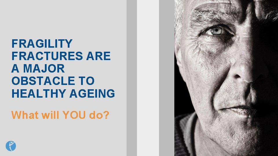 FRAGILITY FRACTURES ARE A MAJOR OBSTACLE TO HEALTHY AGEING What will YOU do? 