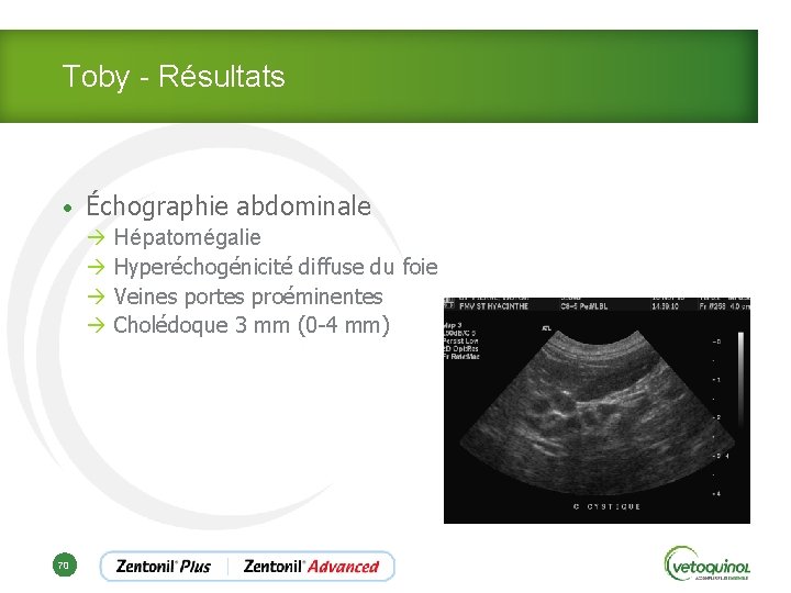 Toby - Résultats • Échographie abdominale à Hépatomégalie à Hyperéchogénicité diffuse du foie à