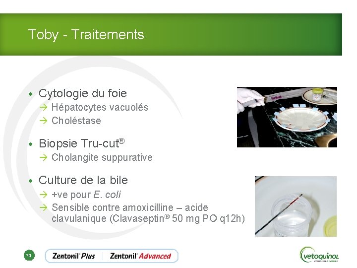 Toby - Traitements • Cytologie du foie à Hépatocytes vacuolés à Choléstase • Biopsie
