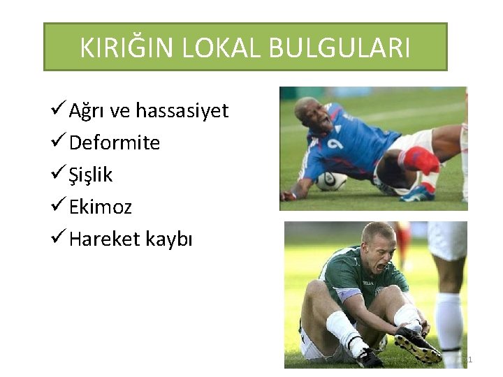 KIRIĞIN LOKAL BULGULARI ü Ağrı ve hassasiyet ü Deformite ü Şişlik ü Ekimoz ü