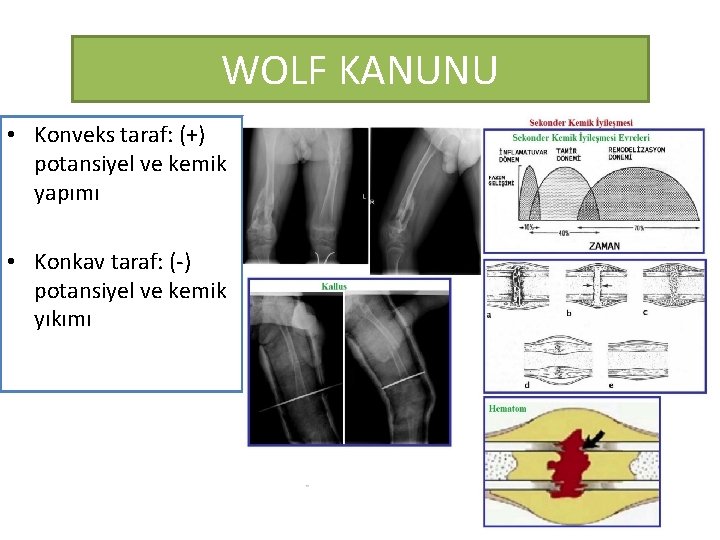 WOLF KANUNU • Konveks taraf: (+) potansiyel ve kemik yapımı • Konkav taraf: (-)