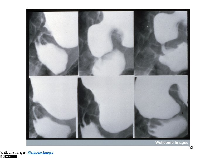 58 Wellcome Images, Wellcome Images 