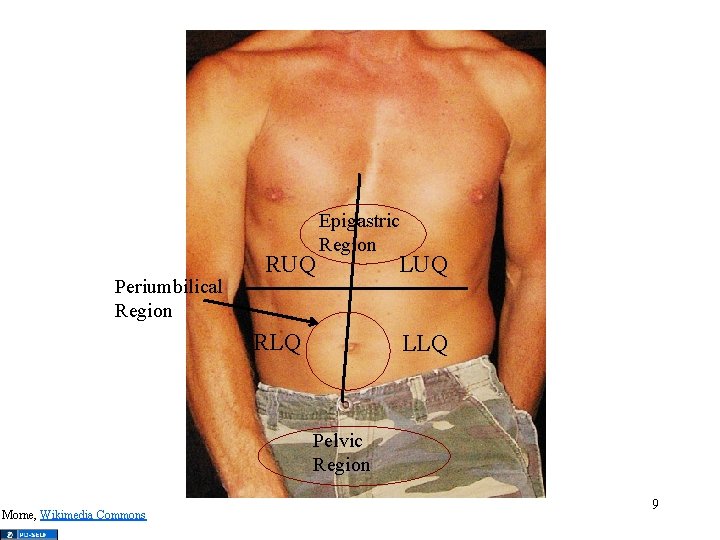 Periumbilical Region RUQ Epigastric Region RLQ LUQ LLQ Pelvic Region Morne, Wikimedia Commons 9