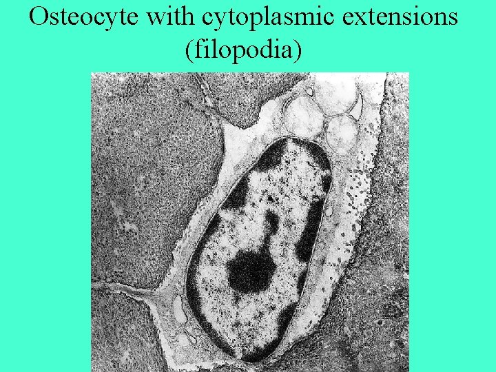 Osteocyte with cytoplasmic extensions (filopodia) 