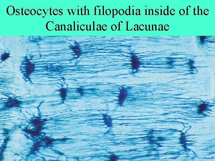 Osteocytes with filopodia inside of the Canaliculae of Lacunae 