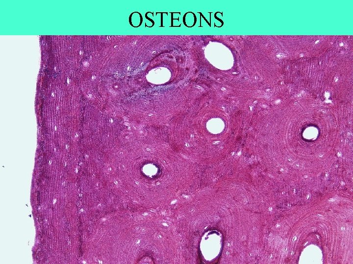 OSTEONS 