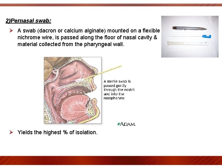 2)Pernasal swab: Ø A swab (dacron or calcium alginate) mounted on a flexible nichrome