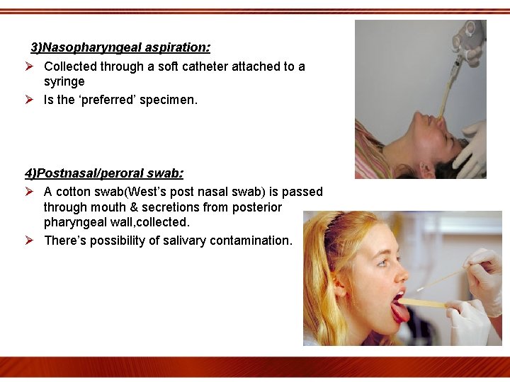 3)Nasopharyngeal aspiration: Ø Collected through a soft catheter attached to a syringe Ø Is