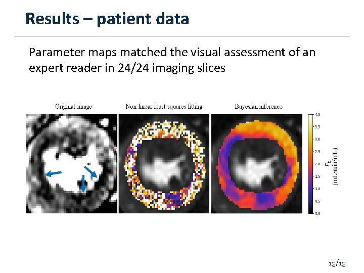 Results – patient data Parameter maps matched the visual assessment of an expert reader