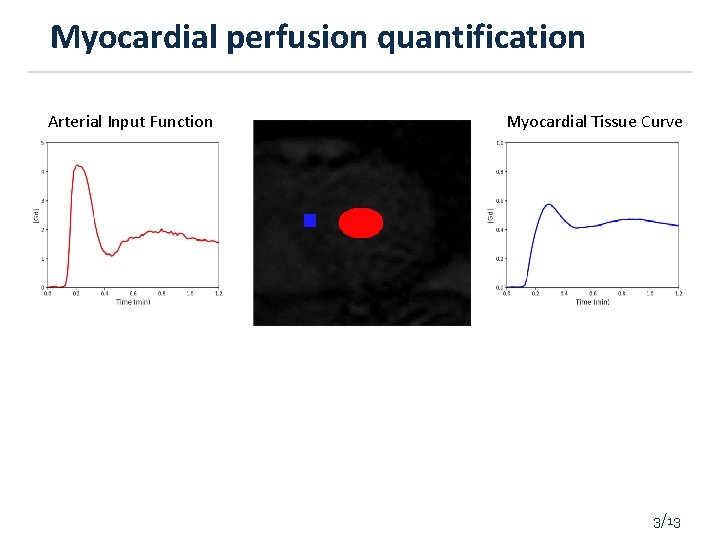 Myocardial perfusion quantification Arterial Input Function Myocardial Tissue Curve 3/13 