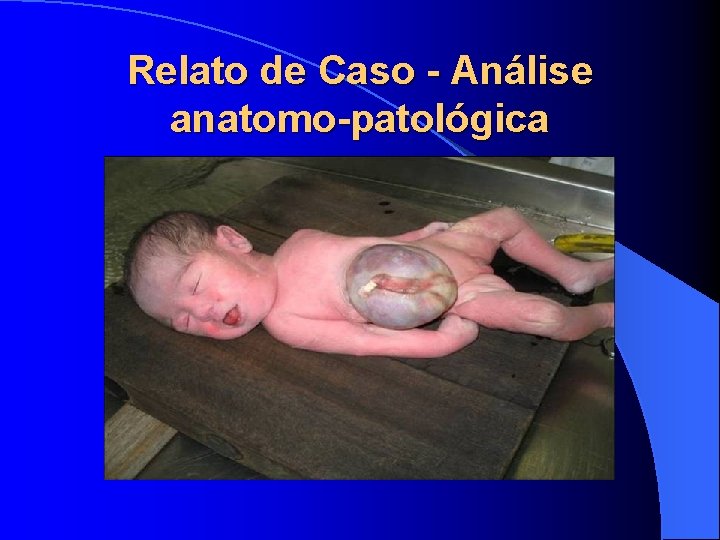 Relato de Caso - Análise anatomo-patológica 