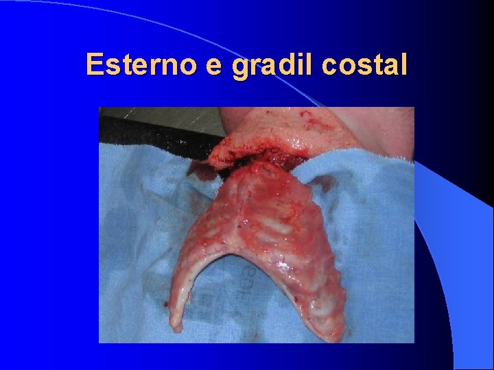 Esterno e gradil costal 