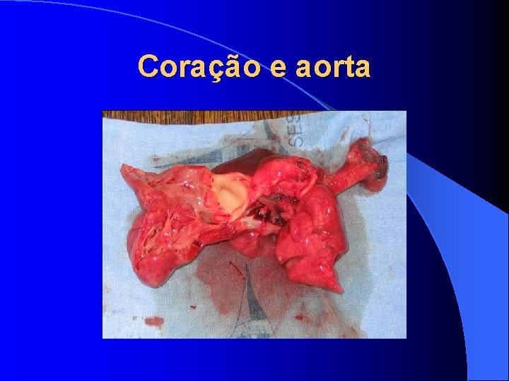 Coração e aorta 