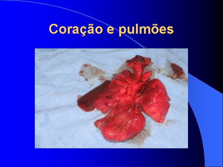 Coração e pulmões 