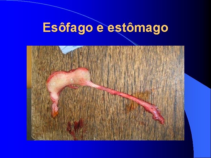 Esôfago e estômago 