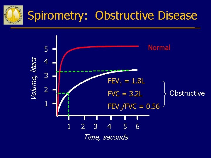 Spirometry: Obstructive Disease Normal Volume, liters 5 4 3 FEV 1 = 1. 8