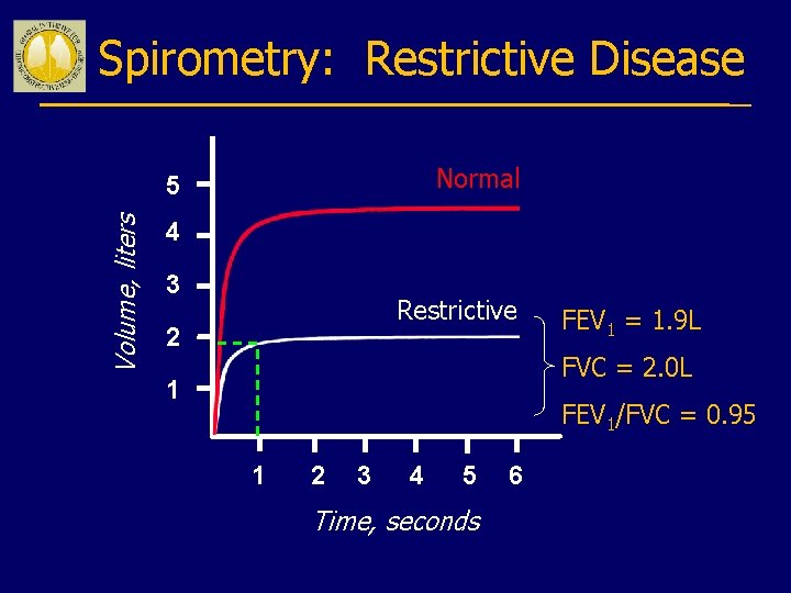 Spirometry: Restrictive Disease Normal Volume, liters 5 4 3 Restrictive 2 FEV 1 =