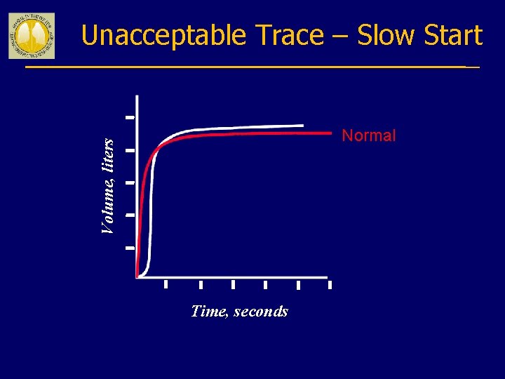 Unacceptable Trace – Slow Start Volume, liters Normal Time, seconds 
