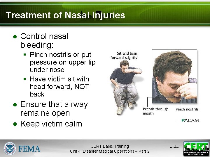 Treatment of Nasal Injuries ● Control nasal bleeding: § Pinch nostrils or put pressure