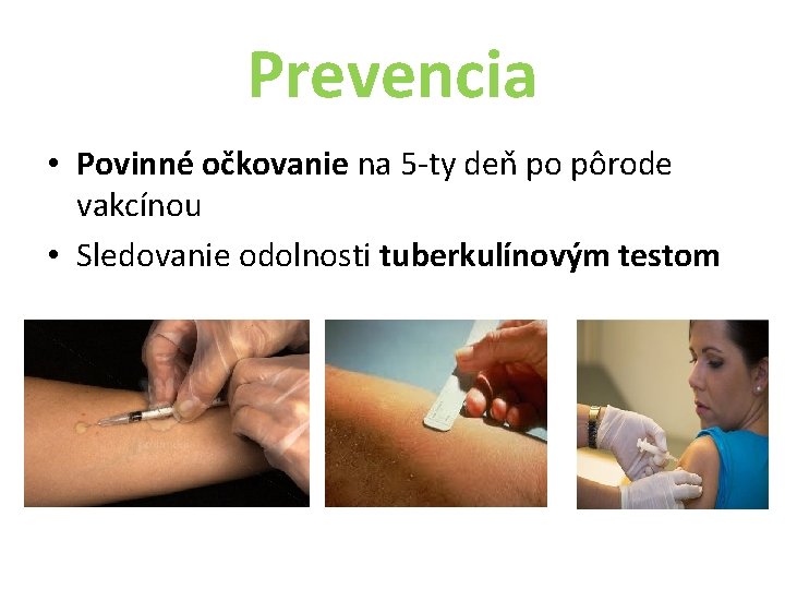 Prevencia • Povinné očkovanie na 5 -ty deň po pôrode vakcínou • Sledovanie odolnosti