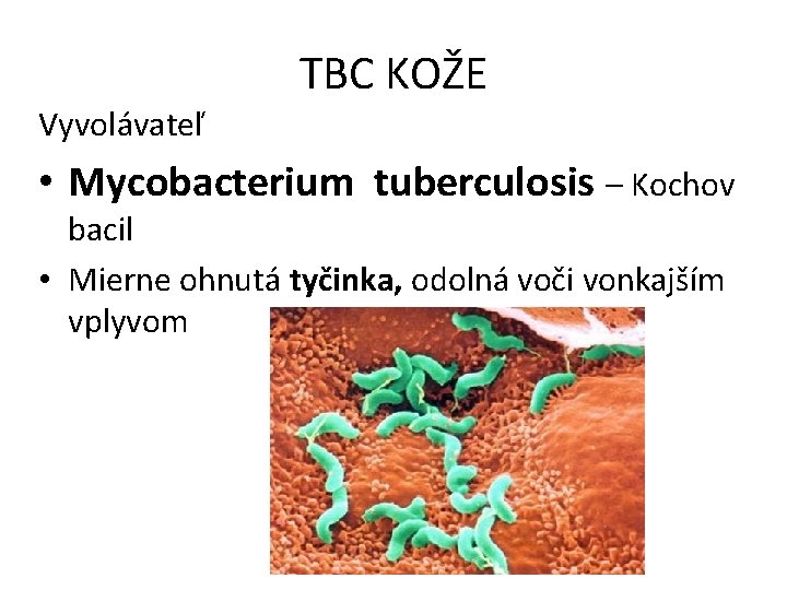 Vyvolávateľ TBC KOŽE • Mycobacterium tuberculosis – Kochov bacil • Mierne ohnutá tyčinka, odolná