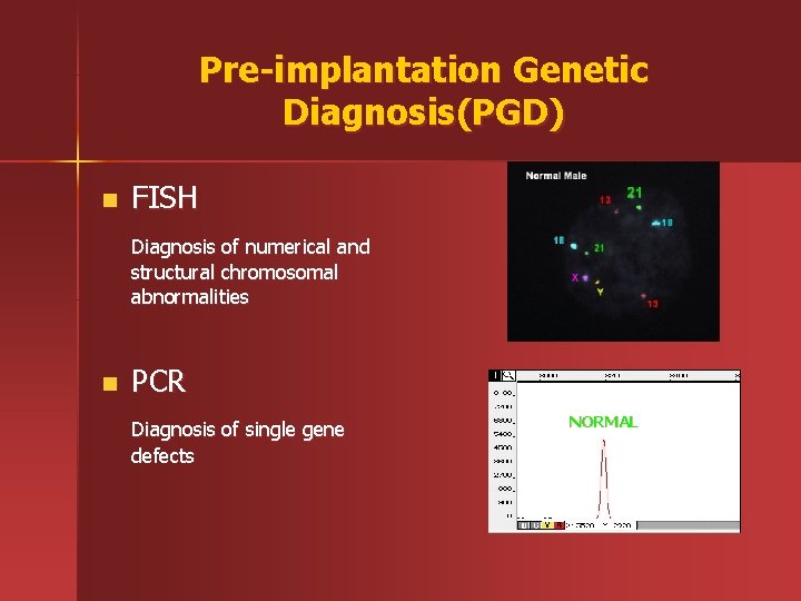 Pre-implantation Genetic Diagnosis(PGD) n FISH Diagnosis of numerical and structural chromosomal abnormalities n PCR