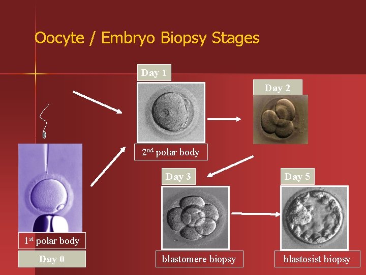 Oocyte / Embryo Biopsy Stages Day 1 Day 2 2 nd polar body Day