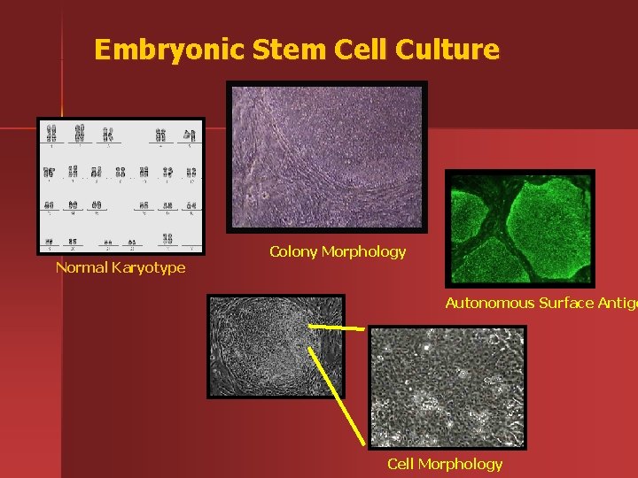 Embryonic Stem Cell Culture Normal Karyotype Colony Morphology Autonomous Surface Antige Cell Morphology 