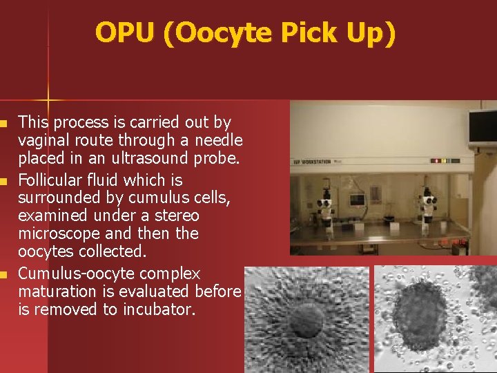 n n n OPU (Oocyte Pick Up) This process is carried out by vaginal