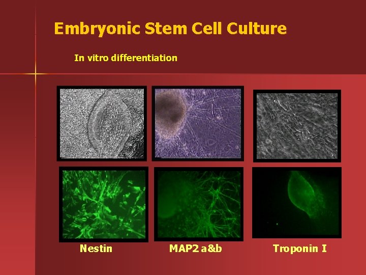 Embryonic Stem Cell Culture In vitro differentiation Nestin MAP 2 a&b Troponin I 