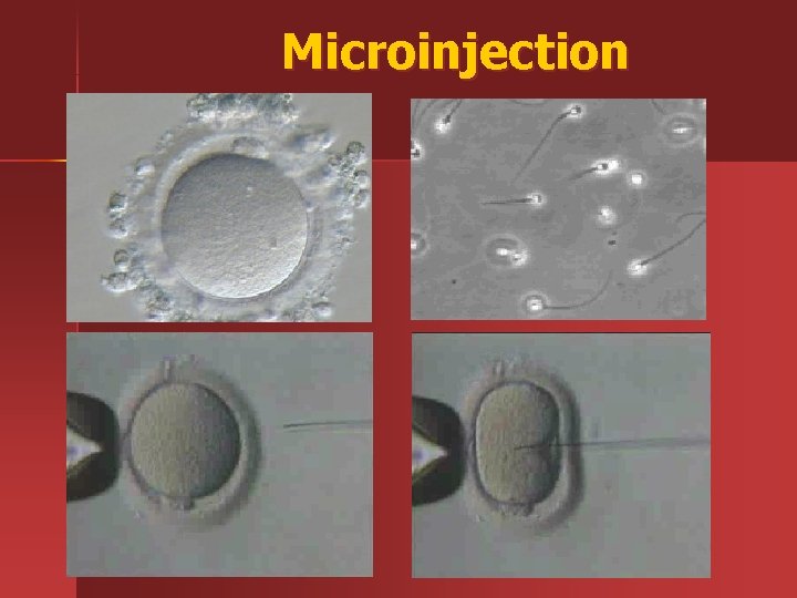 Microinjection 