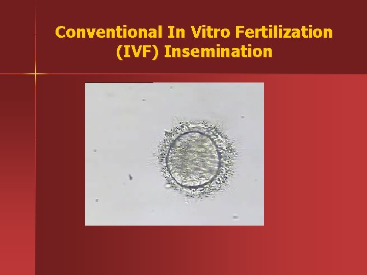 Conventional In Vitro Fertilization (IVF) Insemination 