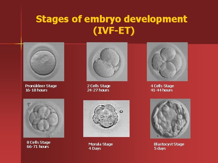 Stages of embryo development (IVF-ET) Pronükleer Stage 16 -18 hours 8 Cells Stage 66