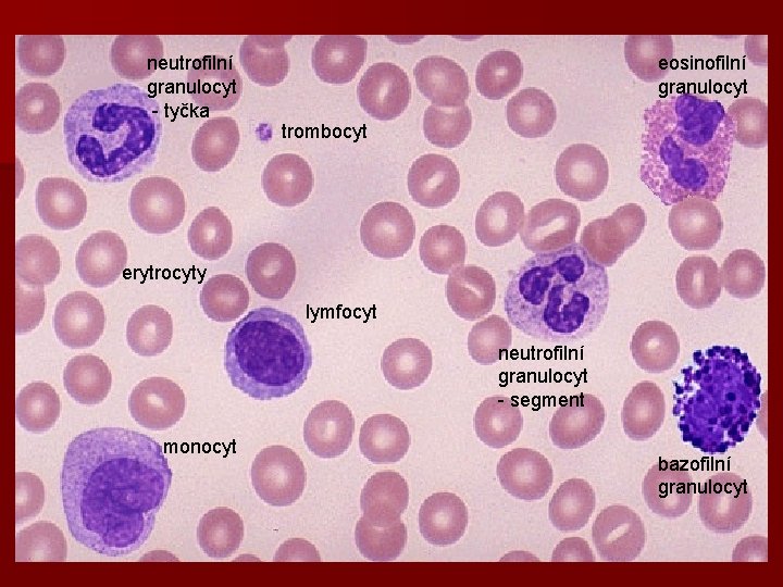 neutrofilní granulocyt - tyčka eosinofilní granulocyt trombocyt erytrocyty lymfocyt neutrofilní granulocyt - segment monocyt