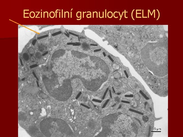 Eozinofilní granulocyt (ELM) 