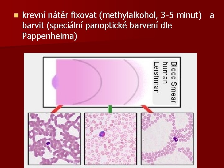 n krevní nátěr fixovat (methylalkohol, 3 -5 minut) a barvit (speciální panoptické barvení dle