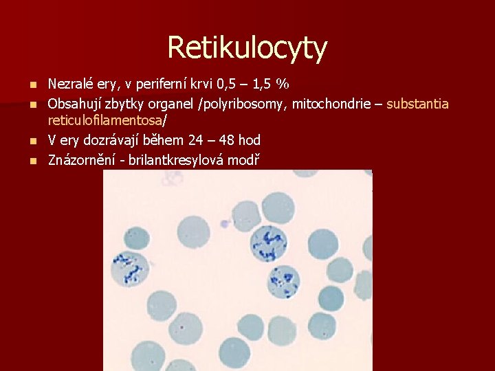Retikulocyty n n Nezralé ery, v periferní krvi 0, 5 – 1, 5 %