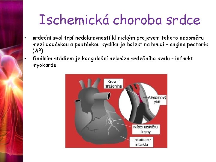 Ischemická choroba srdce • • srdeční sval trpí nedokrevností klinickým projevem tohoto nepoměru mezi
