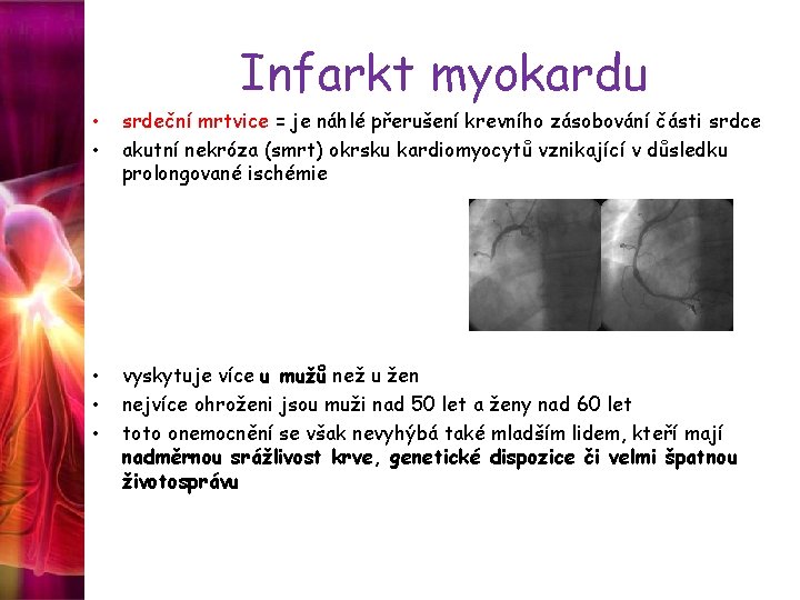 Infarkt myokardu • • srdeční mrtvice = je náhlé přerušení krevního zásobování části srdce