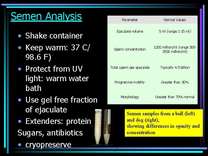 Semen Analysis • Shake container • Keep warm: 37 C/ 98. 6 F) •