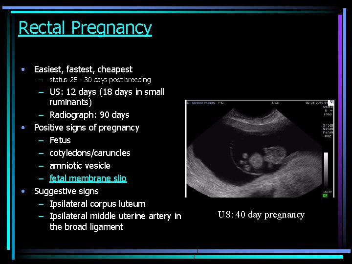 Rectal Pregnancy • Easiest, fastest, cheapest – • • status 25 - 30 days