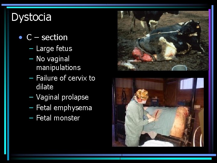 Dystocia • C – section – Large fetus – No vaginal manipulations – Failure