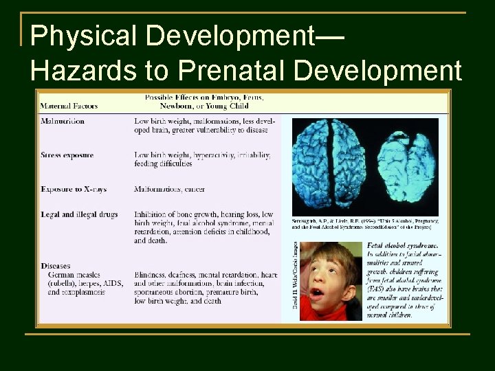 Physical Development— Hazards to Prenatal Development 