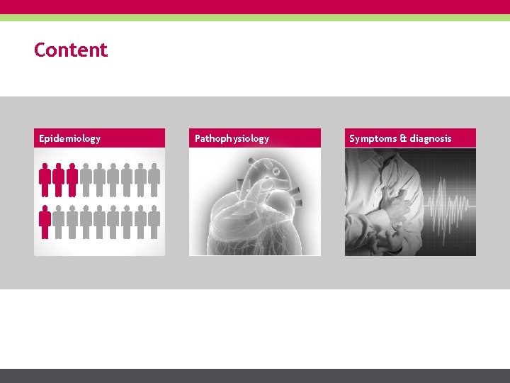 Content Epidemiology Pathophysiology Symptoms & diagnosis 