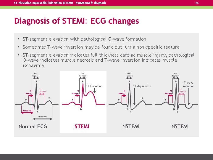 ST-elevation myocardial infarction (STEMI) – Symptoms & diagnosis 26 Diagnosis of STEMI: ECG changes