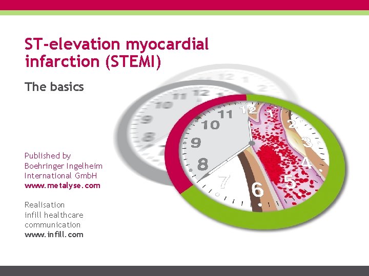 ST-elevation myocardial infarction (STEMI) The basics Published by Boehringer Ingelheim International Gmb. H www.
