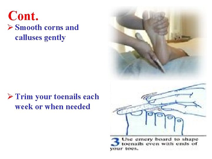 Cont. Ø Smooth corns and calluses gently Ø Trim your toenails each week or